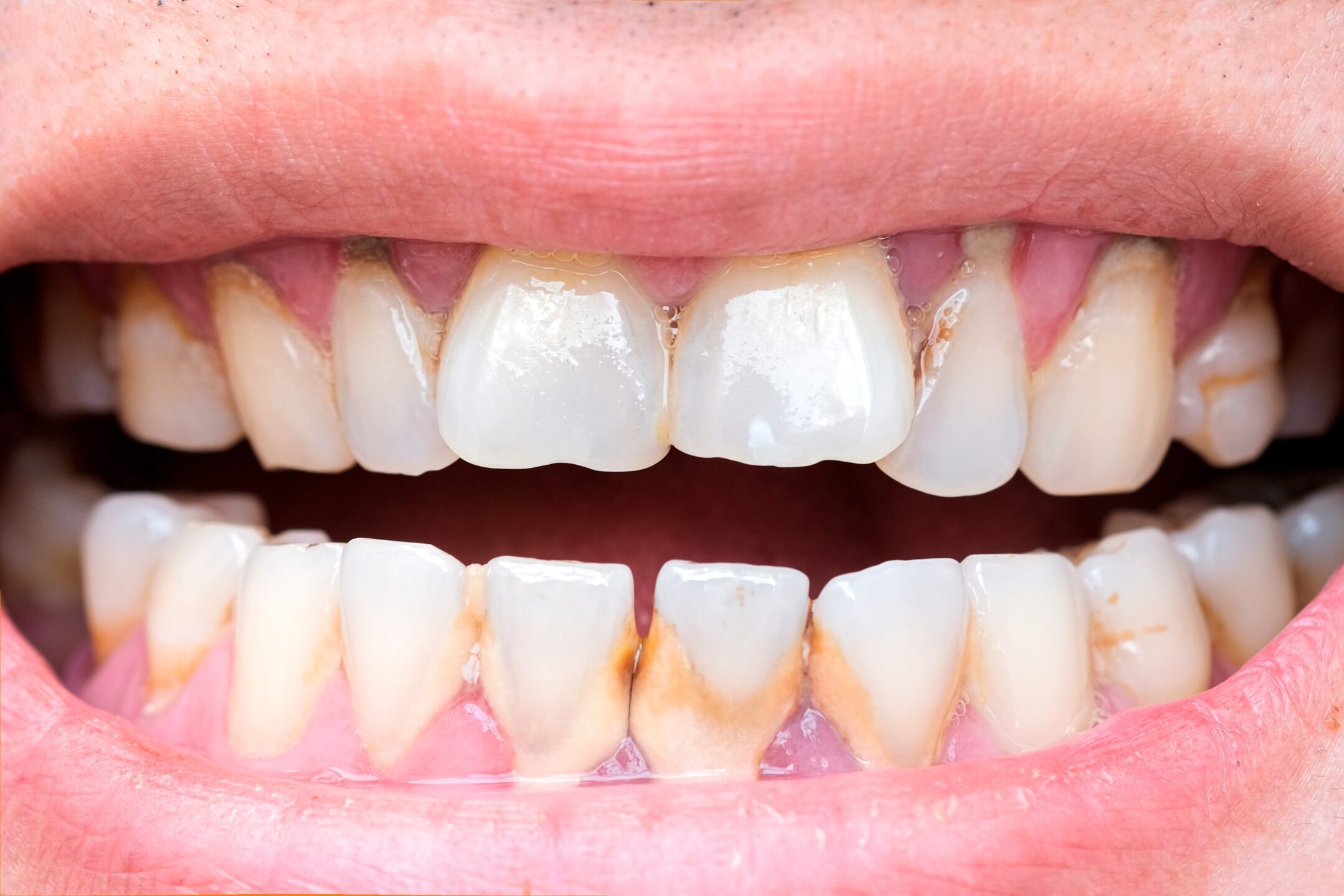 รูปภาพ Belix Dental