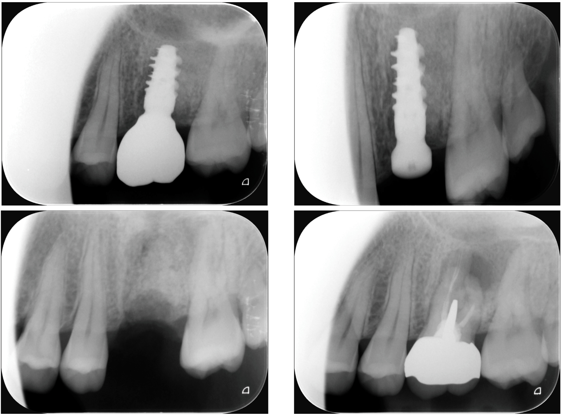 รูปภาพ Belix Dental