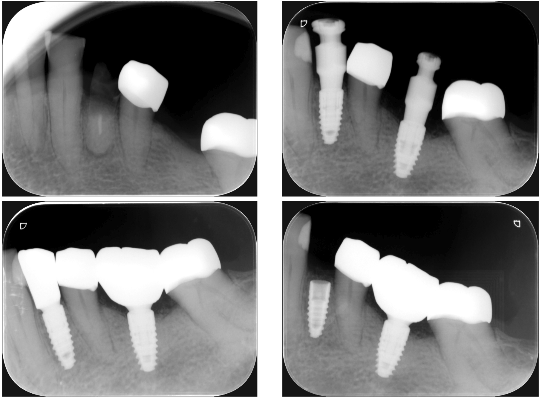 รูปภาพ Belix Dental