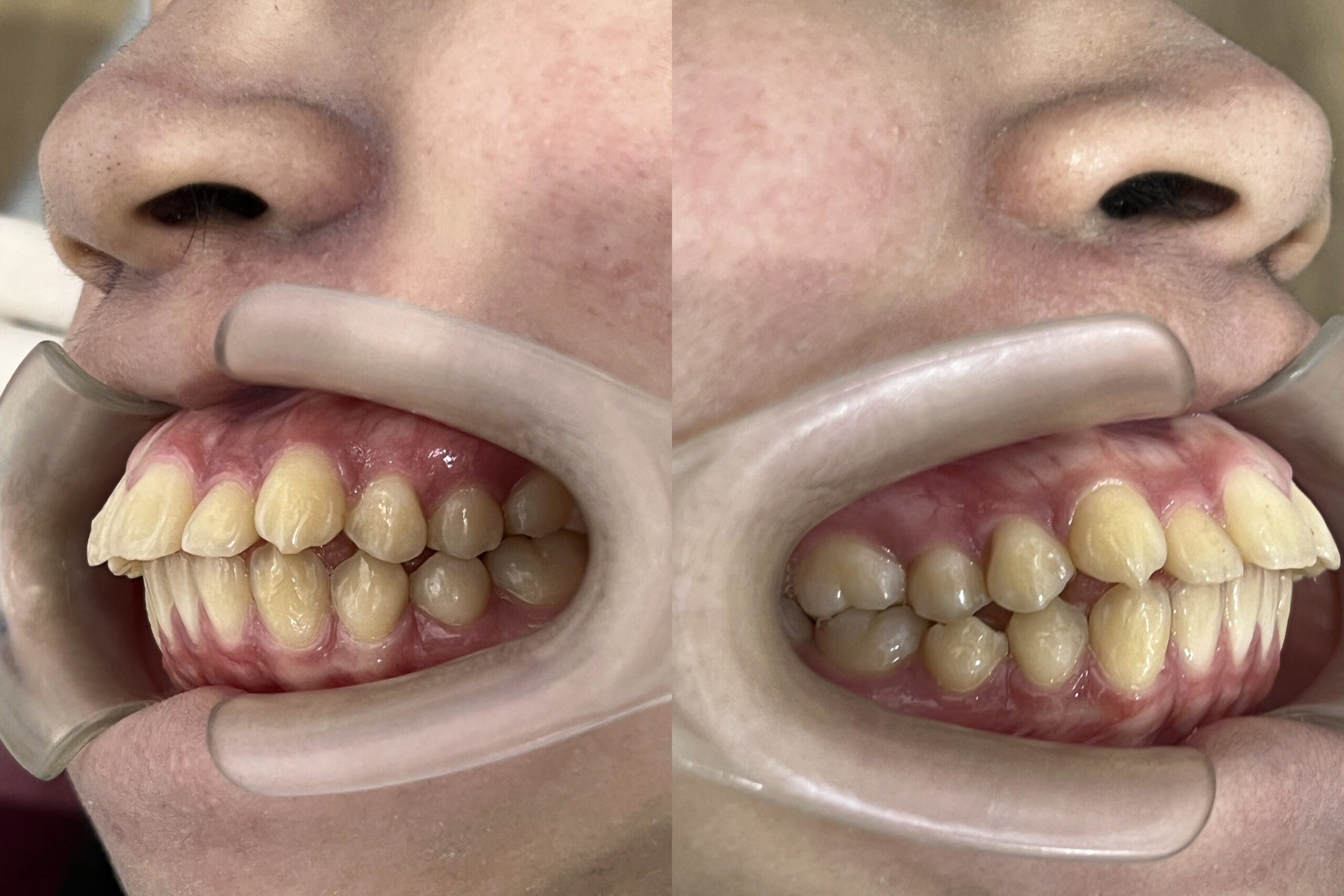 รูปภาพ Belix Dental