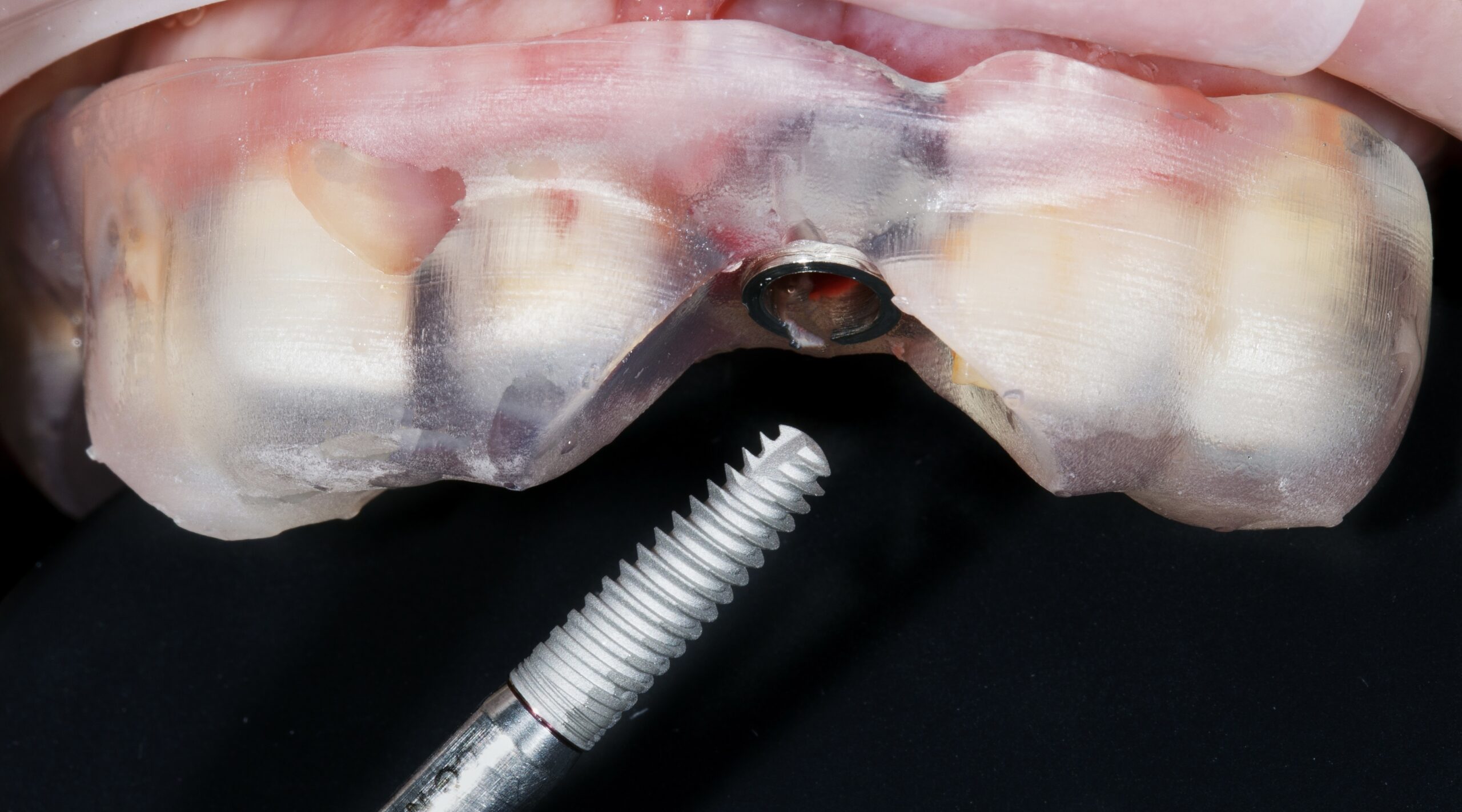 รูปภาพ Belix Dental