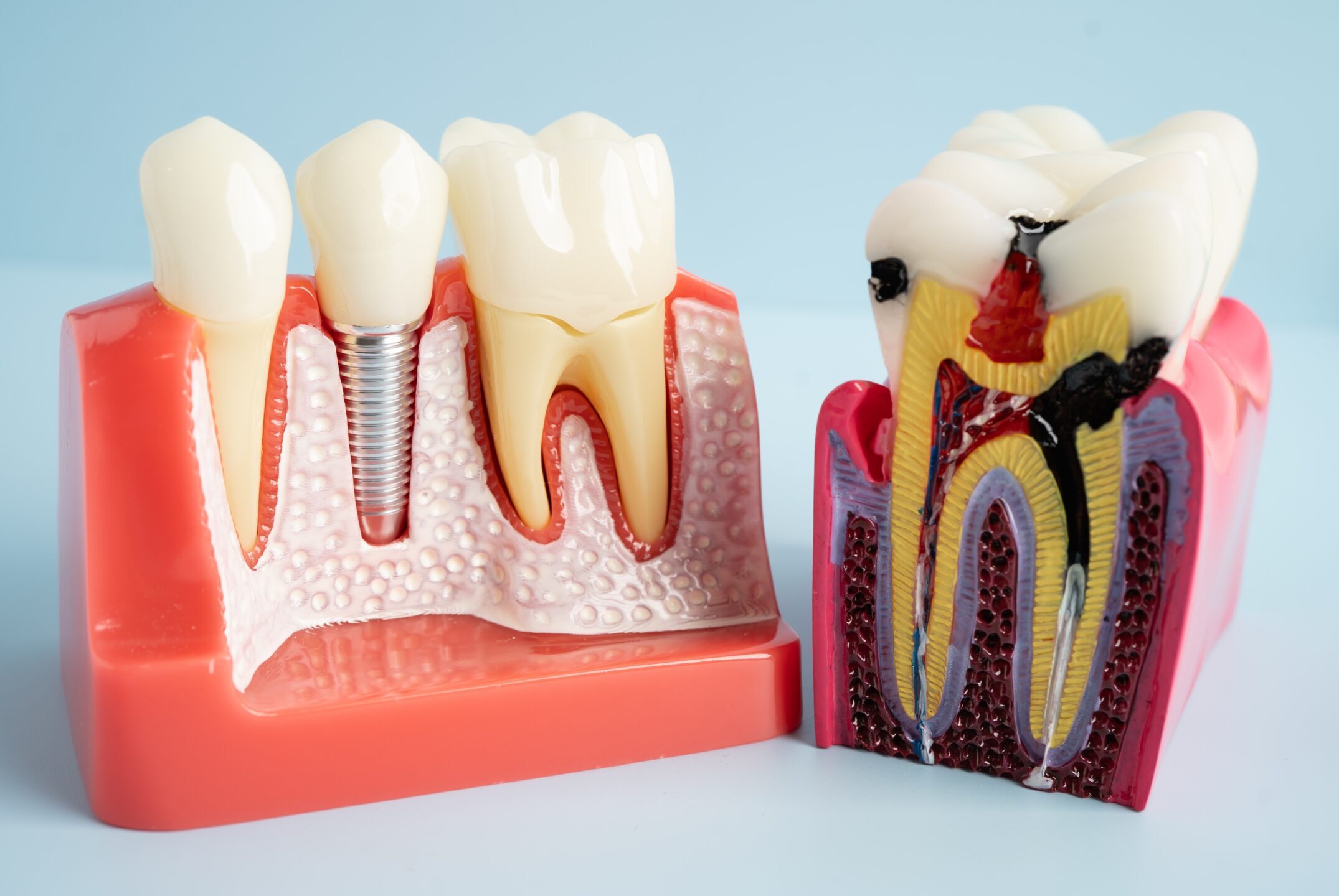 รูปภาพ Belix Dental