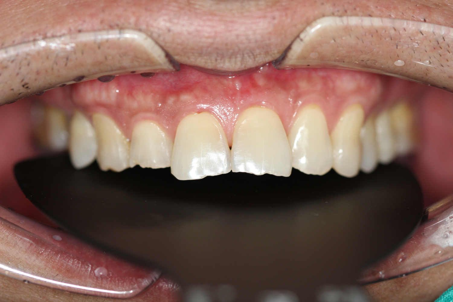 รูปภาพ Belix Dental