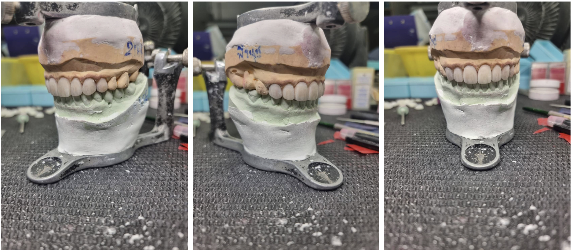 รูปภาพ Belix Dental