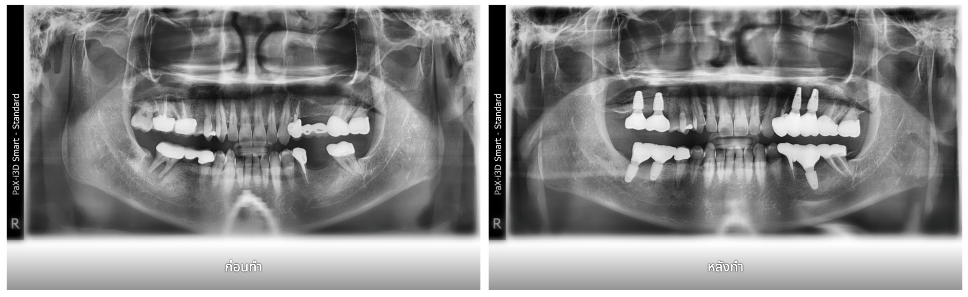 รูปภาพ Belix Dental